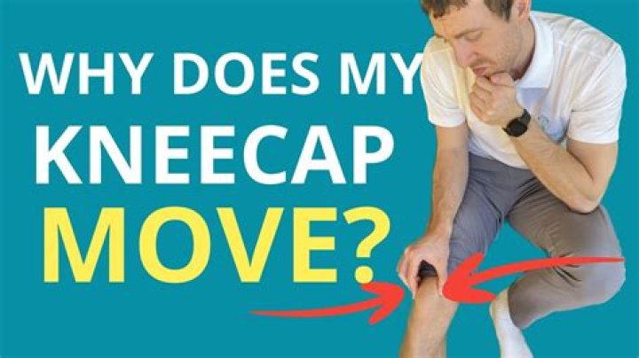 Can knee caps move?