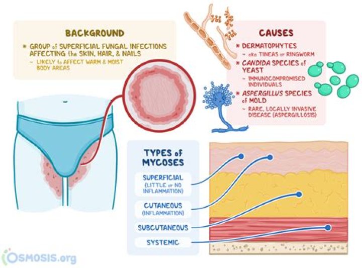 Can macrobid cause yeast infection?