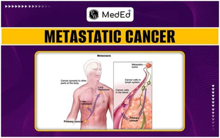 Can metastasis be stopped?