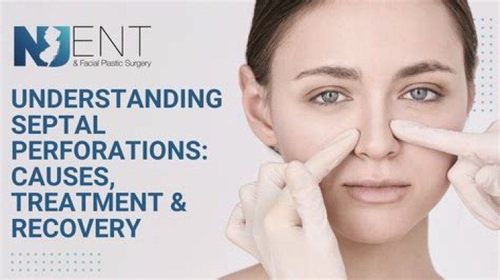 Can septal perforation heal itself?