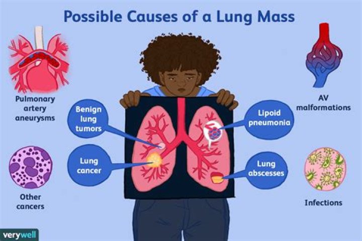 Can serious mass cause cancer?