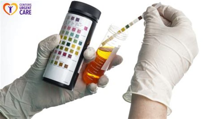 Can urinalysis detect diabetes?
