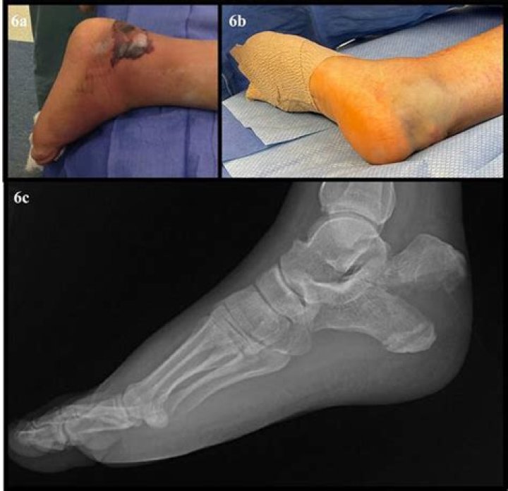 Can xerostomia be cured?