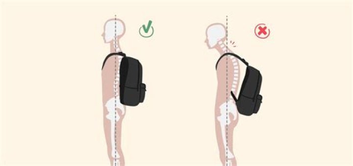 Can you backpack with scoliosis?