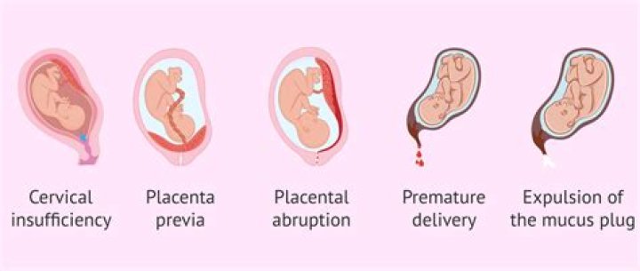 Can you bleed and still be pregnant?