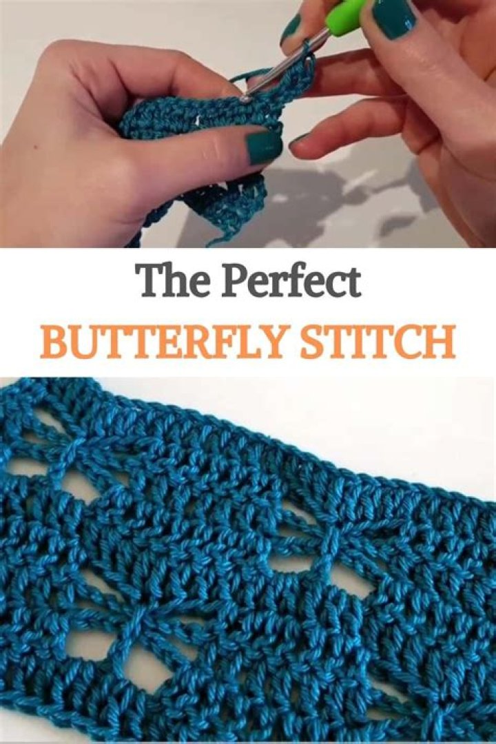 Can you buy butterfly stitches?