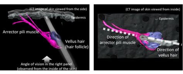 Can you control the arrector pili muscle?