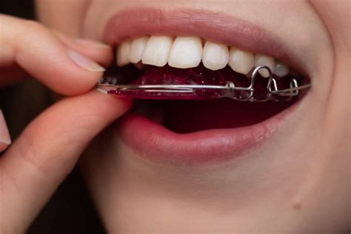 Can you drink with hawley retainers on?