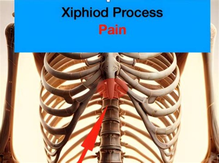 Can you feel the xiphoid?