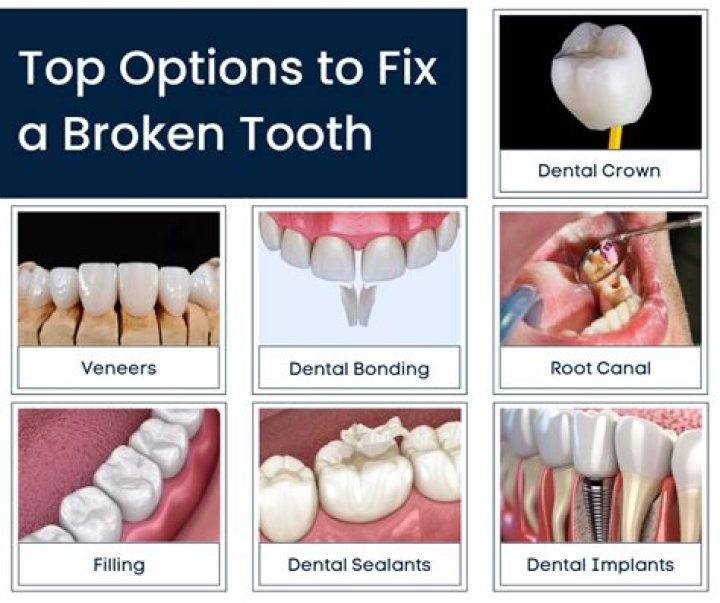 Can you fix a worn down tooth?