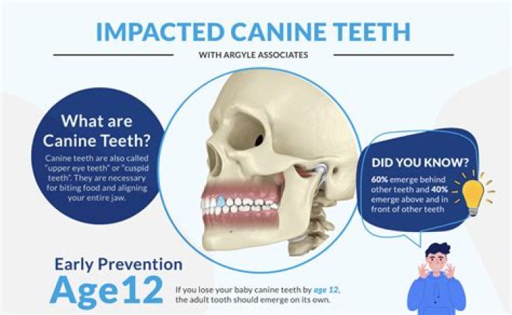 Can you get sharper canine teeth?