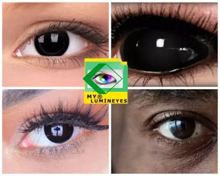Can you have black eyes?