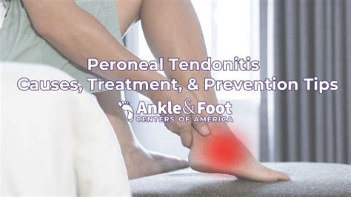 Can you walk with peroneal tendonitis?