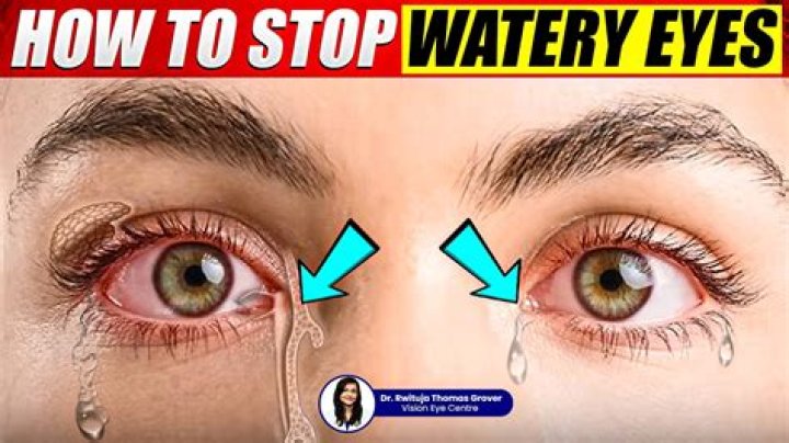 Can't stop my eyes watering?