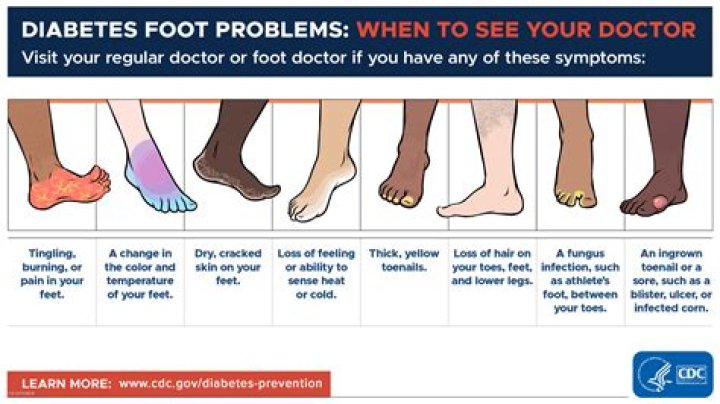 Could foot pain be diabetes?