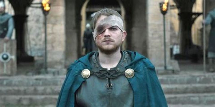 Did aethelwold lose an eye?