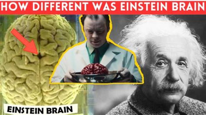 Did albert einstein's brain get stolen?