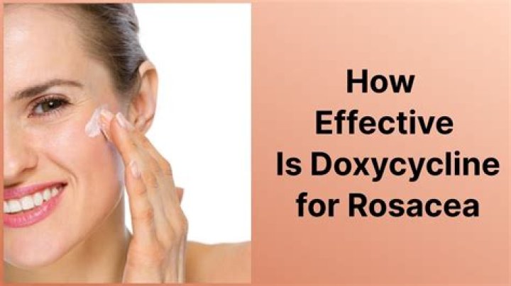 Did doxycycline help your rosacea?