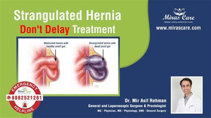 Do all hernias become strangulated?