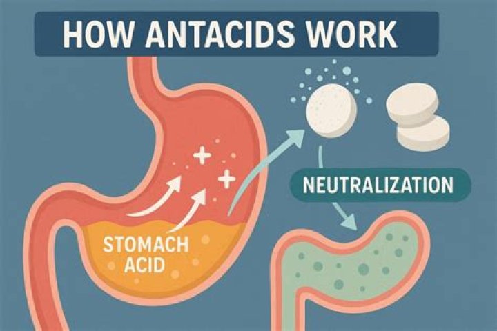 Do antacids help gallstone pain?