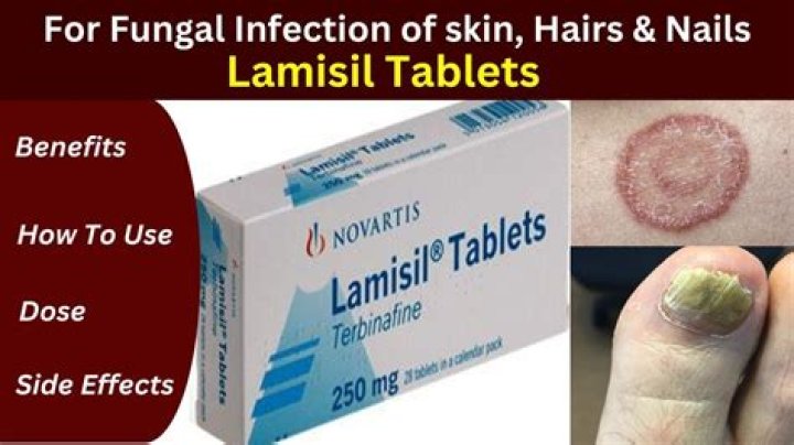 Do antifungal tablets have side effects?