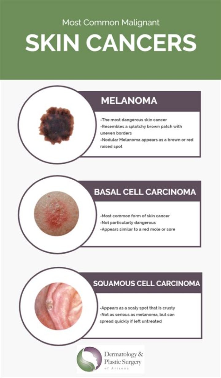 Do cancer lumps itch?