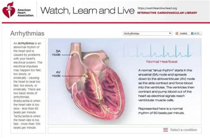 Do defibrillators restart the heart?