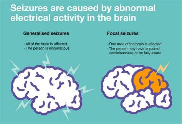 Do flickering lights cause seizures?