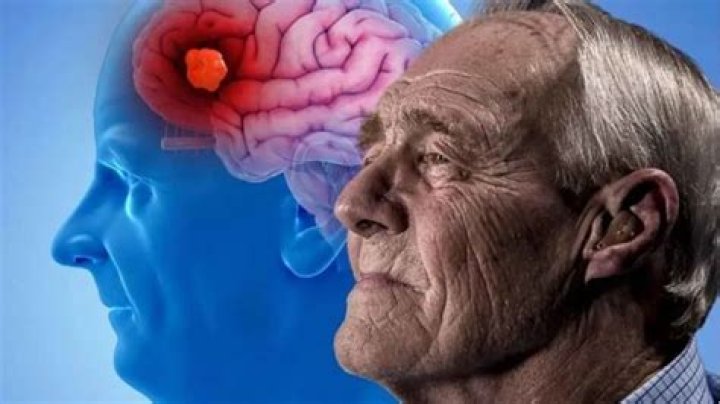 Do i have neurosis?