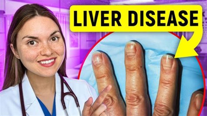 Do liver problems cause itching?