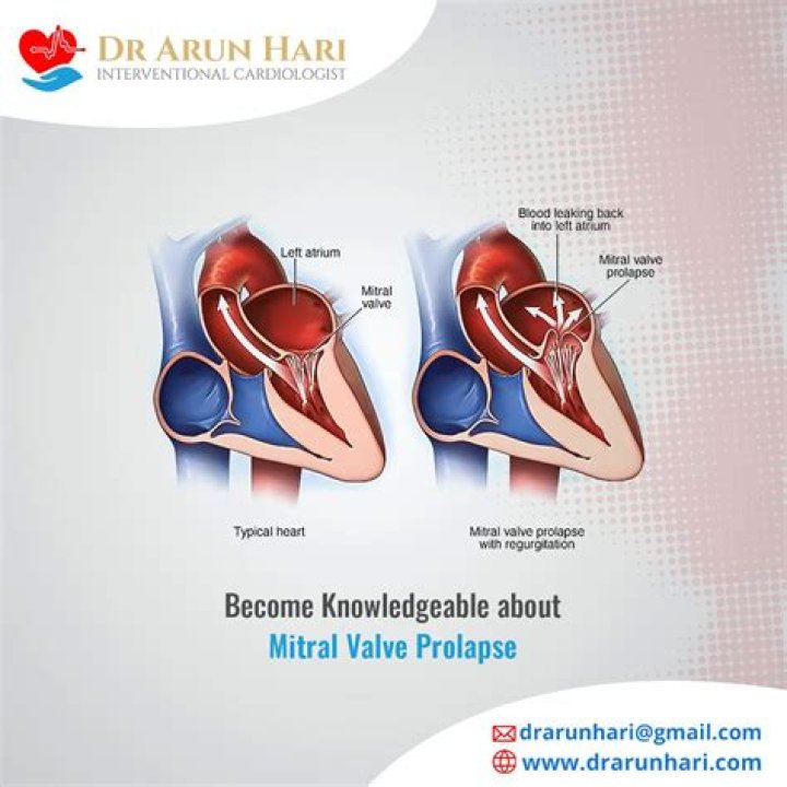 Do mitral valve prolapse go away?