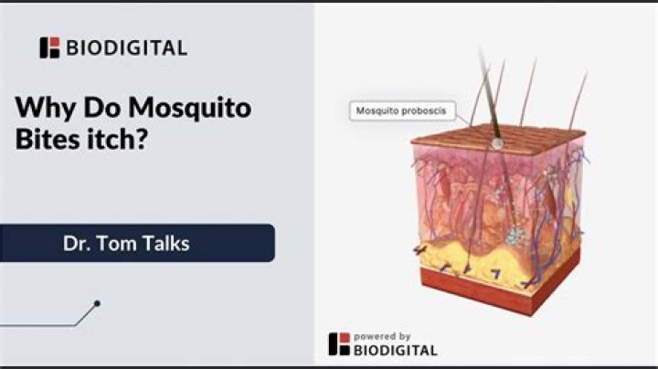 Do mosquito bites itch?