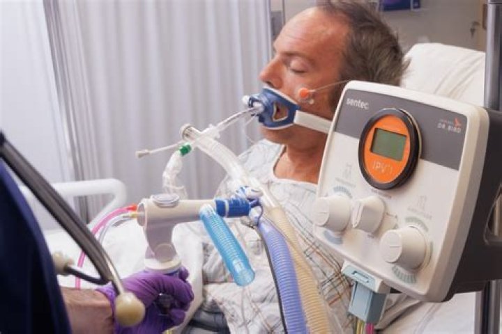Do patients on ventilator survive?