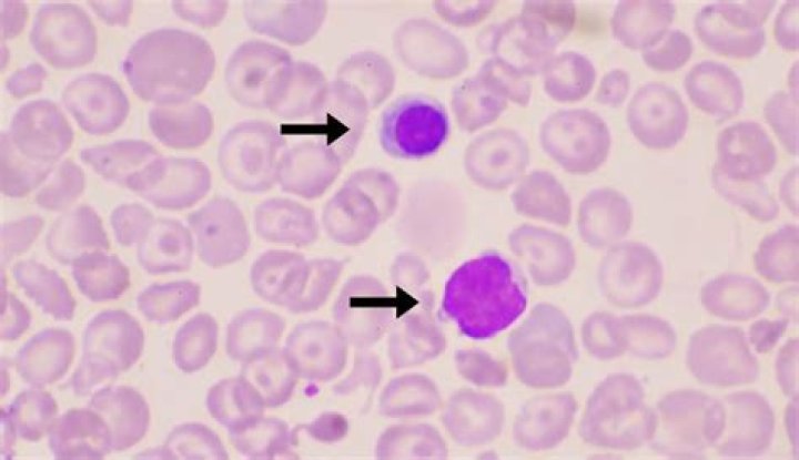 Do reticulocytes have hemoglobin?