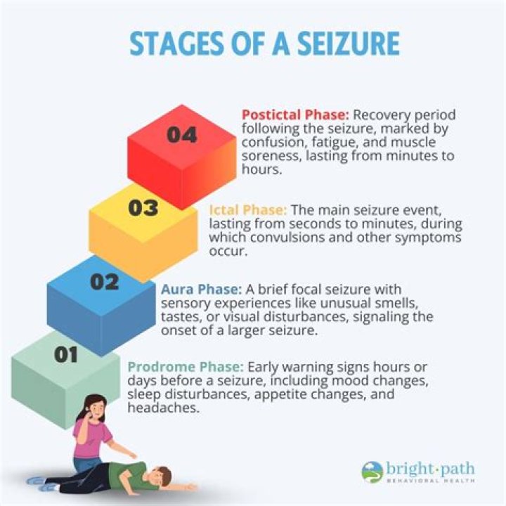 Do seizures always show up on eeg?