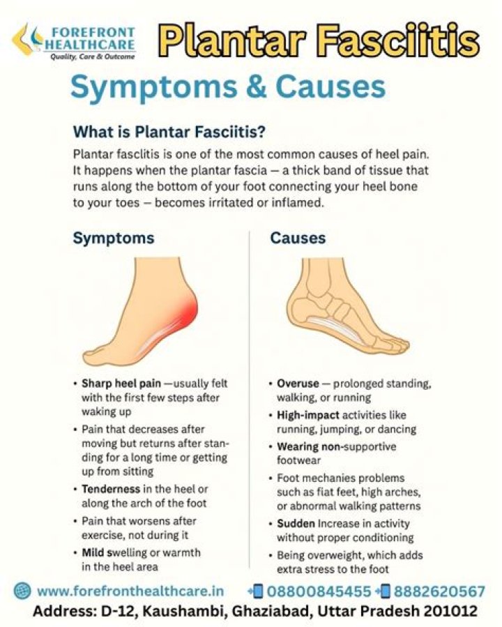 Do shoes cause plantar fasciitis?