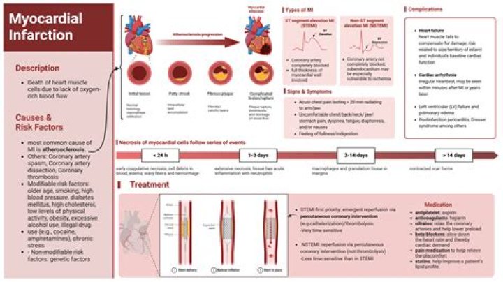 Do steroids cause myocardial infarction?