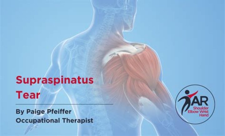 Do supraspinatus tears heal?