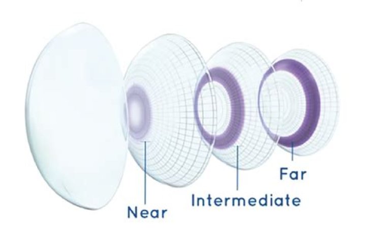 Do they make bifocal contact lenses?