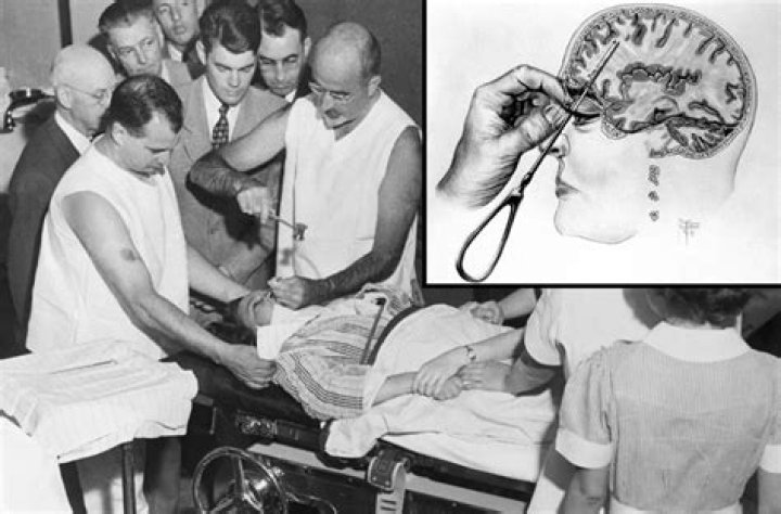 Do they still use lobotomy?
