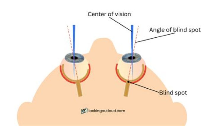 Do we have a blind spot?