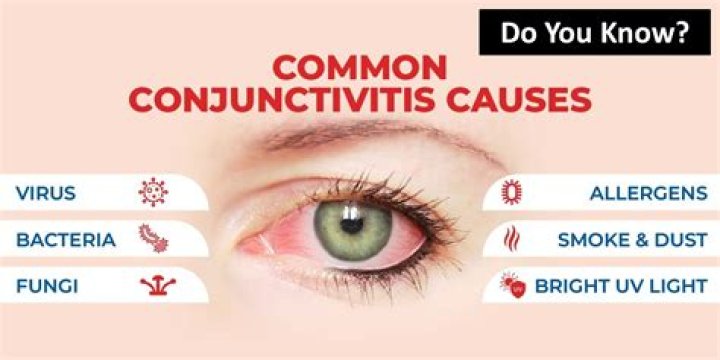 Do you get conjunctivitis with covid?