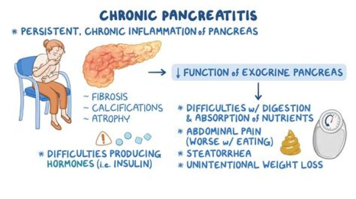 Do you lose weight with acute pancreatitis?