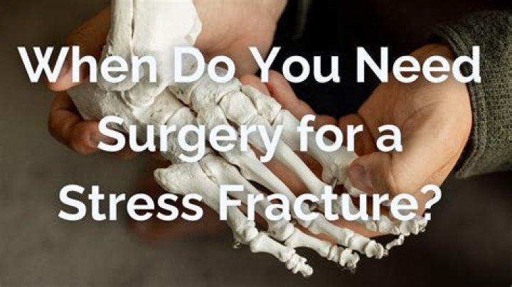 Do you need surgery for sever's disease?