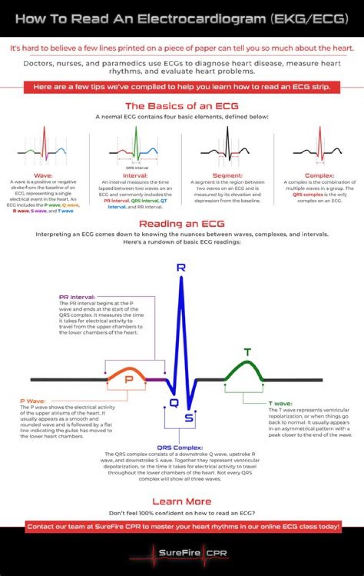 Do you need to fast before an electrocardiogram?