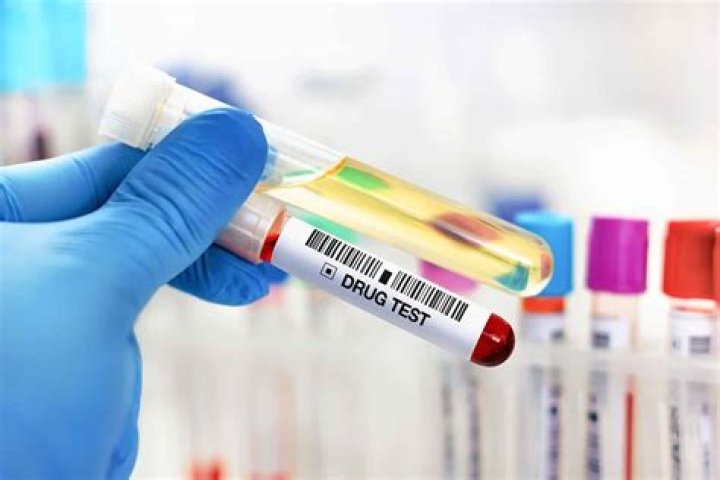 Does aisin drug test?