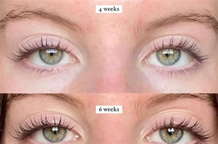 Does an eyelash lift damage your lashes?