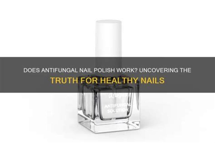 Does antifungal nail polish work?