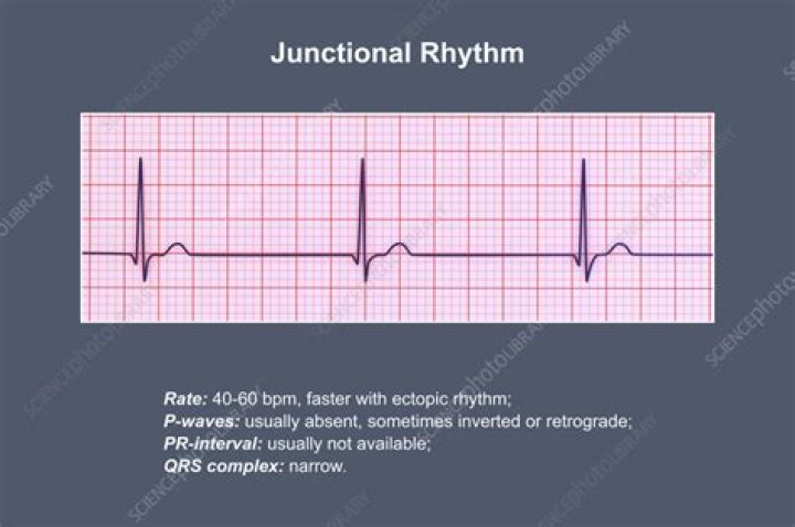 Does atropine work on junctional rhythms?