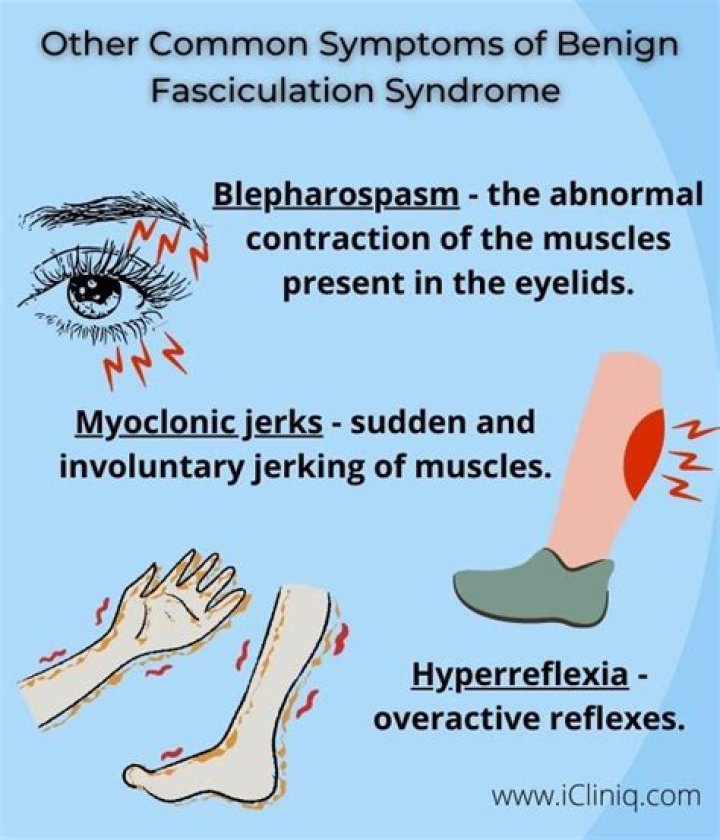 Does benign fasciculation syndrome cause pain?